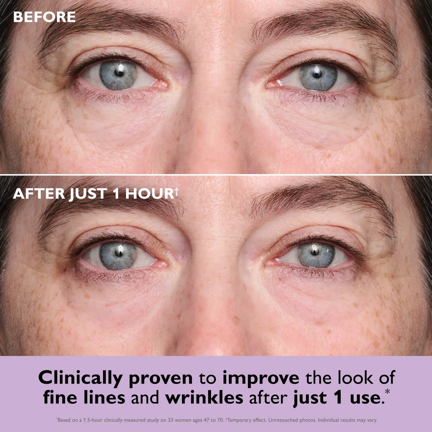 Collagen Infusion Eye Patches – Instantly Firm, Brighten & Revive Tired Eyes