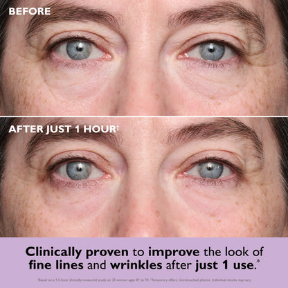 Collagen Infusion Eye Patches – Instantly Firm, Brighten & Revive Tired Eyes