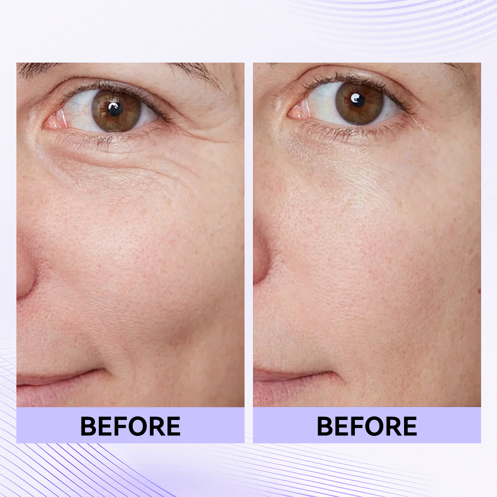 Sale Happening Now:70%OFF🔥 Instant Eye Tightener Easy-Wear Formula With Brush Free!