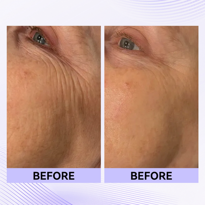 Sale Happening Now:70%OFF🔥 Instant Eye Tightener Easy-Wear Formula With Brush Free!